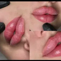 مطب زیبایی تپش .جشنواره تخفیف/لیزر/ژل بوتاکس|خدمات آرایشگری و زیبایی|گلبهار, شهر جدید گلبهار|دیوار