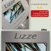 اسکراب پاکسازی اسکالپ مو