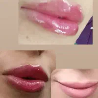 ژل و بوتاکس|خدمات آرایشگری و زیبایی|قم, باجک یک|دیوار