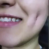 آموزش تتو بدن . پیرسینگ . چال گونه و برداشتن خال|خدمات آرایشگری و زیبایی|بروجرد, |دیوار