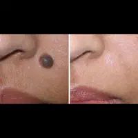 کلینیک تخصصی پوست ماهور (ستاره پوست(|خدمات آرایشگری و زیبایی|زابل, |دیوار