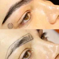 کاشت ابرو با تیم تخصصی در لرستان