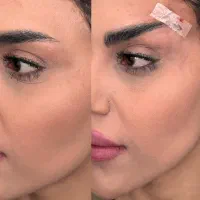 آموزشب وتاکس ژل فیلر نخ لیفت لیزر مو طب سنتی فشیال|خدمات آموزشی|اصفهان, جلفا|دیوار