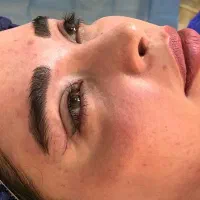 مرکز تخصصی بلفاروپلاستی(لینا سرجری)