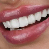 استخدام دستیار دندانپزشک