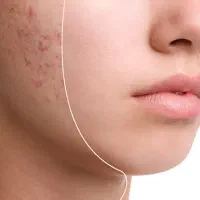 ضدجوش تضمینی