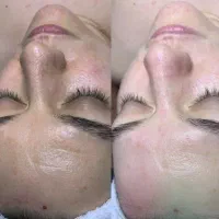 مدل فیشیالcip+ماساژصورت +پکیج rfجوانسازفقط۴۹۰|خدمات آرایشگری و زیبایی|کرج, فاز ۲ مهرشهر|دیوار