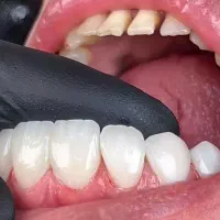 دندانپزشکی با پرداخت اقساطی