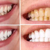 خدمات دندانپزشکی با شرایط ویژه|خدمات آرایشگری و زیبایی|زنجان, |دیوار