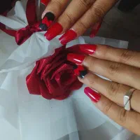 کاشت فقط 499