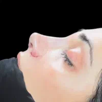 ساکشن غبغب تزریق چربی جراحی عمل بینی بایپس|خدمات آرایشگری و زیبایی|تهران, صادقیه|دیوار