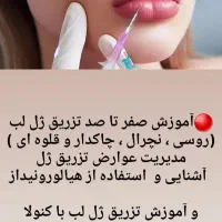 آموزش تخصصی تزریق ژل و بوتاکس|خدمات آموزشی|جهرم, |دیوار
