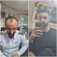 تیم تخصصی کاشت مو تحت نظر پزشک