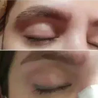 پاک کردن تتو قدیمی و خدمات زیبایی