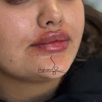 تخفیفات درمانگاه زیبایی