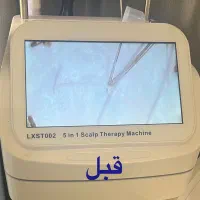 مدل اسکراپ و اسکالپ سر