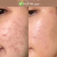 زیبایی پوستی محصولات مراقبتی|آرایشی، بهداشتی، درمانی|رباط‌کریم, شهرستانک|دیوار