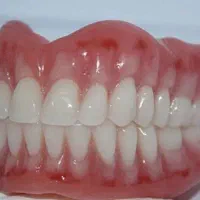 دندانسازی و ساخت دست دندان برای بی دندانی کامل