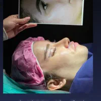 جشنواره بلفارو پلاستی پلک فقط 8500