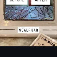 میکرواسکالپ اسکراپ کاشتمو درمجموعه زیبانو|خدمات آرایشگری و زیبایی|مشهد, گوهرشاد|دیوار