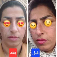 درمان تمامی مشکلات با محصولات ماسکانی|آرایشی، بهداشتی، درمانی|اصفهان, باغ فردوس|دیوار