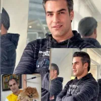 کاشت مو وابرو