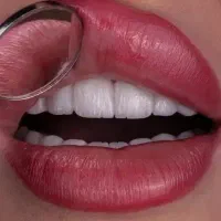 جشنواره تخفیف دندانپزشکی رها کامپوزیت و لمینیت و..