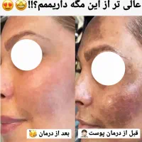 امسال عید همه رو شگفت زده کن