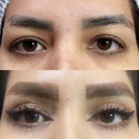 جراحی‌های زیبایی توسط متخصص در بیمارستان قم|خدمات آرایشگری و زیبایی|قم, بلوار امین و ساحلی|دیوار