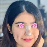 پیرسینگ کل بدن و چال گونه دائم با نخ (۸سال سابقه