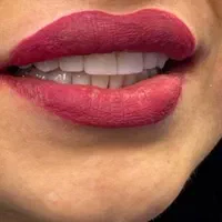 کامپوزیت فکی ۶ تومان/لمینیت / بیلیچینگ/روکش|خدمات آرایشگری و زیبایی|تهران, اوقاف|دیوار