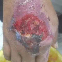 تزریقات وپانسمان در منزل|خدمات آرایشگری و زیبایی|نجفآباد, قدس|دیوار