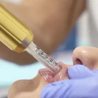 تزریق فیلر ،ژل و بوتاکس با دستگاه|خدمات آموزشی|شیراز, گویم|دیوار