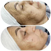 اولین اتاق پوست صومعه سرا با تراپی های درمانی|خدمات آرایشگری و زیبایی|صومعه‌سرا, |دیوار