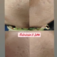 آموزش تخصصی کارهای پوستی با پنجاه درصد تخفیف|خدمات آموزشی|بابل, |دیوار