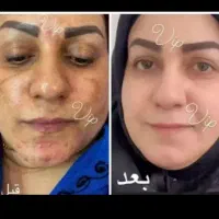 کرم سفید کننده و ضد لک ضد پیری رفع چروک جوش پوست|آرایشی، بهداشتی، درمانی|تهران, کامرانیه|دیوار