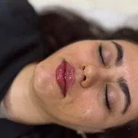 جشنواره لابیاپلاستی تزریق چربی تزریق فیلربادی غبغب|خدمات آرایشگری و زیبایی|تهران, عبدل‌آباد|دیوار