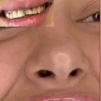 دندانپزشکی زیبایی پالیش ایمپلنت عصب کشی جرم گیری|خدمات زیبایی و سلامت|تهران, ایران|دیوار
