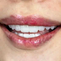 جشنواره پاییزه دندانپزشکی|خدمات آرایشگری و زیبایی|قم, آزادگان|دیوار