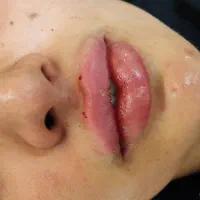 ژل، بوتاکس و چربی سوزی تخصصی در هفت‌حوض