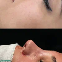 آف عمل زیبای