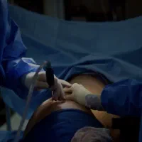 لیپوساکشن حرفه ای نقدی و اقساطی