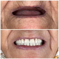 دندان مصنوعی تخصص ماست..|خدمات آرایشگری و زیبایی|پردیس, فاز ۸|دیوار