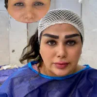 مرکز فوق تخصصی( کاشت مو ۱۴ م/کاشت ابرو ۱۰م)|خدمات آرایشگری و زیبایی|اندیشه, اندیشه فاز ۱|دیوار