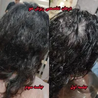 اسکراب اسکالپ|خدمات آرایشگری و زیبایی|رشت, رشتیان|دیوار
