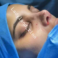 جشنواره جراحی بینی۲۵ تومن .جراحی صورت واندام|خدمات آرایشگری و زیبایی|اسلامشهر, شهرک مهدیه|دیوار