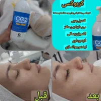 فشیال کلاسیکvip پوست فقط 400تومان به جای 600تومان|خدمات آرایشگری و زیبایی|کرمان, |دیوار