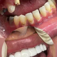 کامپوزیت دندان|خدمات آرایشگری و زیبایی|سبزوار, کاشفی شمالی (دادگستری)|دیوار