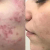 آرایشی بهداشتی درمانی