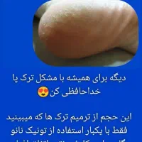 تونیک نانو وگان حاوی کلوئید نقره «آریا